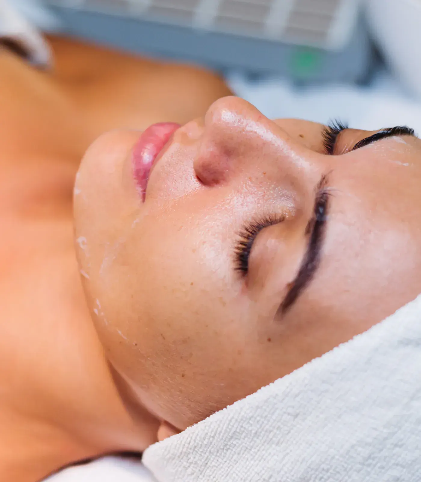 Peeling chimique professionnel appliqué sur le visage dans une clinique esthétique à Trois-Rivières